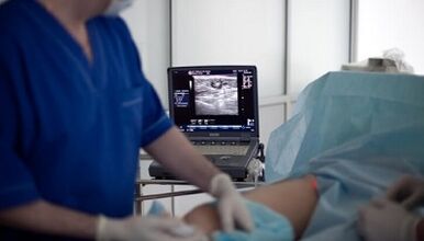 Chirurgische Behandlung von Krampfadern