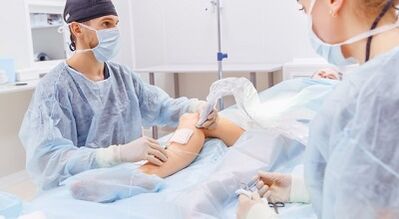 Krampfadern Operation